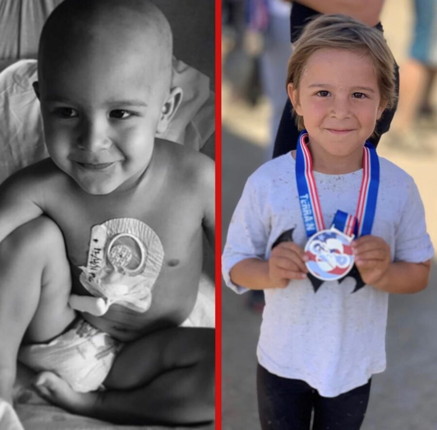 Before and after photo of a child. On the left, bald with medical device, on the right healthy with a medallion around their neck,